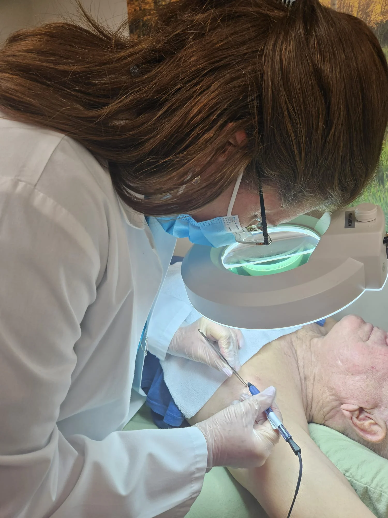 Close-up of gloved hands holding fine forceps and an electrocautery pen over a client's upper arm under a lit magnifier lamp